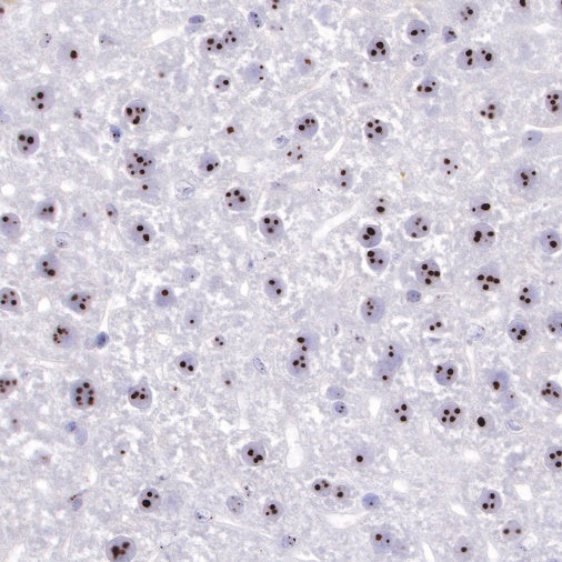Nucleophosmin/NPM Recombinant Rabbit mAb (S-R231)
