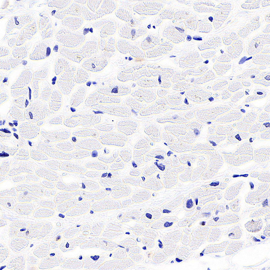 SLC43A2 Recombinant Rabbit mAb (S-4492-33)
