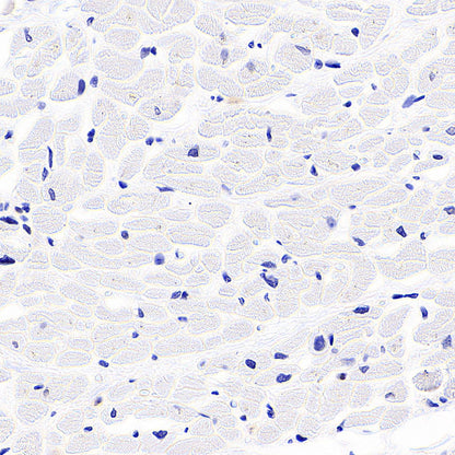 SLC43A2 Recombinant Rabbit mAb (S-4492-33)