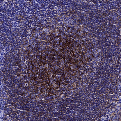 CD82 Recombinant Rabbit mAb (S-673-44)