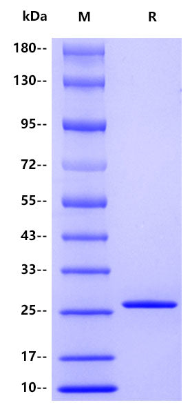 Human ATRX , His tag – AntBio