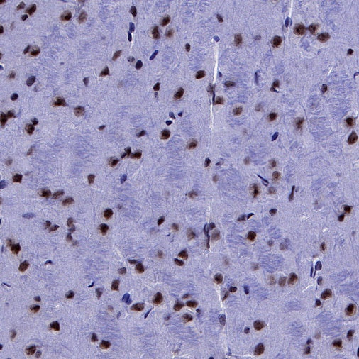 p27 Recombinant Rabbit mAb (S-141-135)