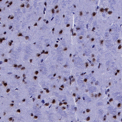 p27 Recombinant Rabbit mAb (S-141-135)