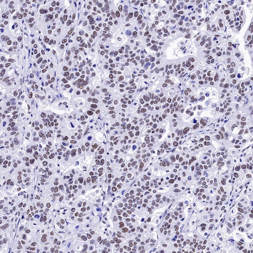 U2AF2 Recombinant Rabbit mAb (S-1324-1)