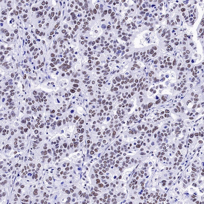 U2AF2 Recombinant Rabbit mAb (S-1324-1)