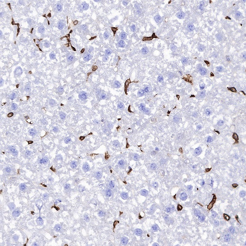 Heme Oxygenase 1 Recombinant Rabbit mAb (S-R334)