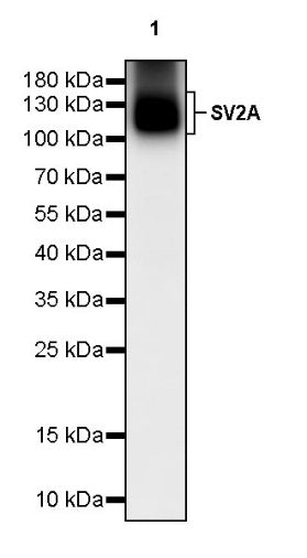 SV2A Recombinant Rabbit mAb (S-2096-2)