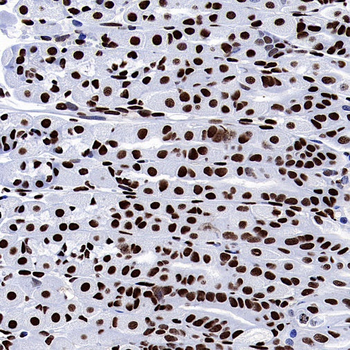 FUS Recombinant Rabbit mAb (S-1015-21)