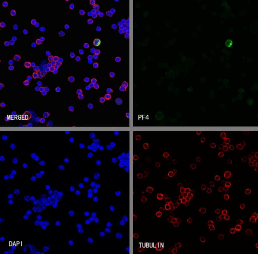 PF4 Recombinant Rabbit mAb (S-4220)