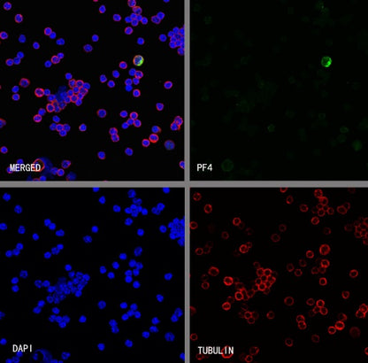 PF4 Recombinant Rabbit mAb (S-4220)