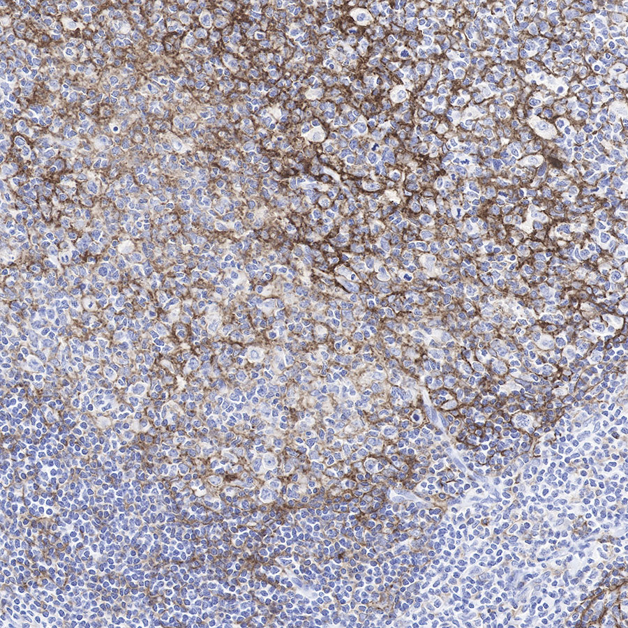 CD11b Recombinant Rabbit mAb,PBS Only (SDT-058-44)