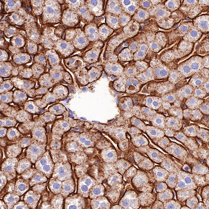 Asialoglycoprotein Receptor 1 Recombinant Rabbit mAb (SDT-292-48)