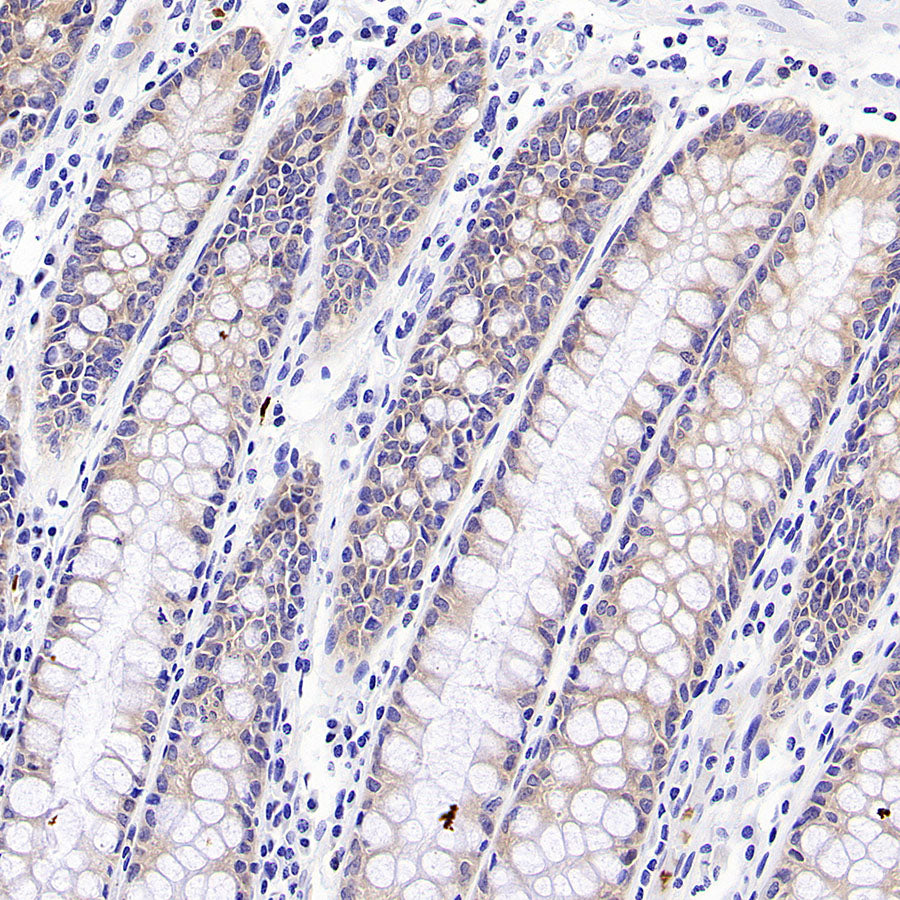 STK39 Recombinant Rabbit mAb (S-3630-15)