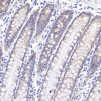 STK39 Recombinant Rabbit mAb (S-3630-15)