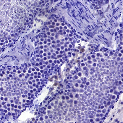 StAR Recombinant Rabbit mAb (S-2520-24)