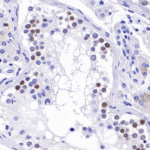 SALL4 Recombinant Rabbit mAb (SDT-1484-1)