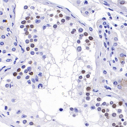 SALL4 Recombinant Rabbit mAb (SDT-1484-1)