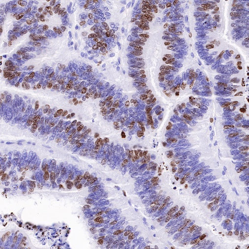 Ki67 Mouse mAb (SDT-606-33)