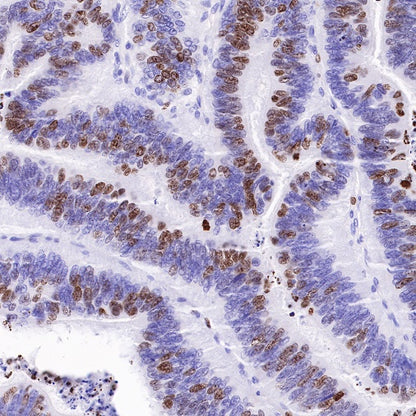 Ki67 Mouse mAb (SDT-606-33)