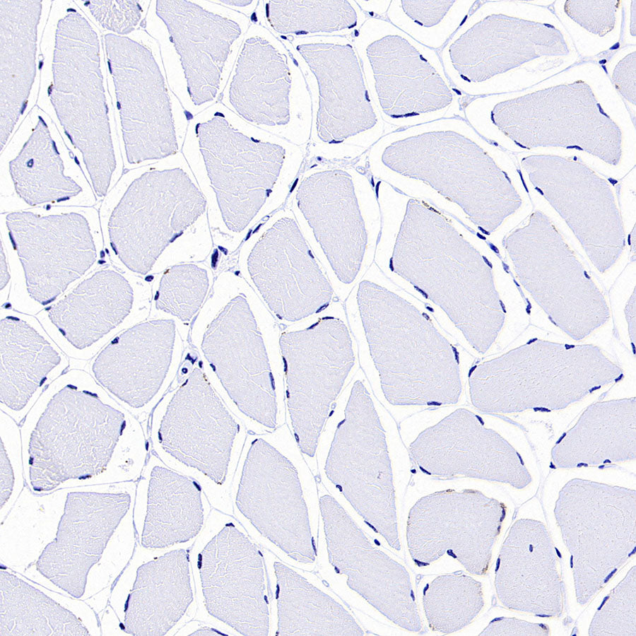 TRDC/TCR delta Recombinant Rabbit mAb (S-5148)
