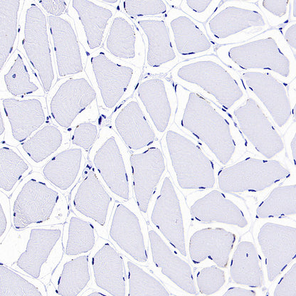 TRDC/TCR delta Recombinant Rabbit mAb (S-5148)