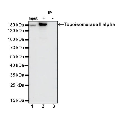 S-RMab®Rabbit mAb IgG Isotype Control (S-R058)