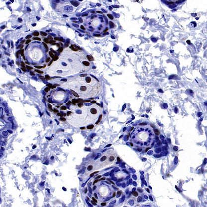 EGR2 Recombinant Rabbit mAb (S-741-136)