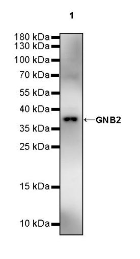 GNB2 Recombinant Rabbit mAb (S-645-10)