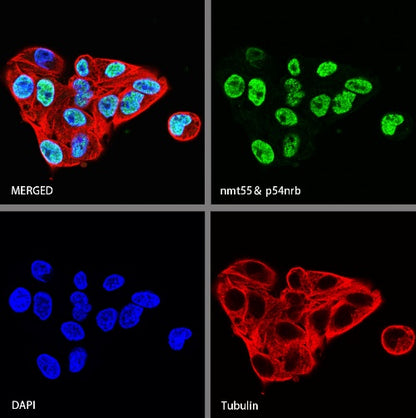 nmt55/p54nrb Recombinant Rabbit mAb (S-1745-48)