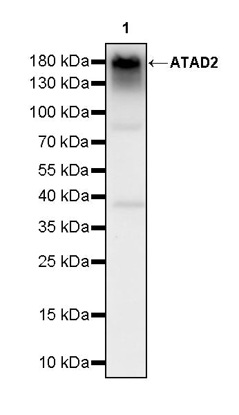 ATAD2 Recombinant Rabbit mAb (S-4145-63)