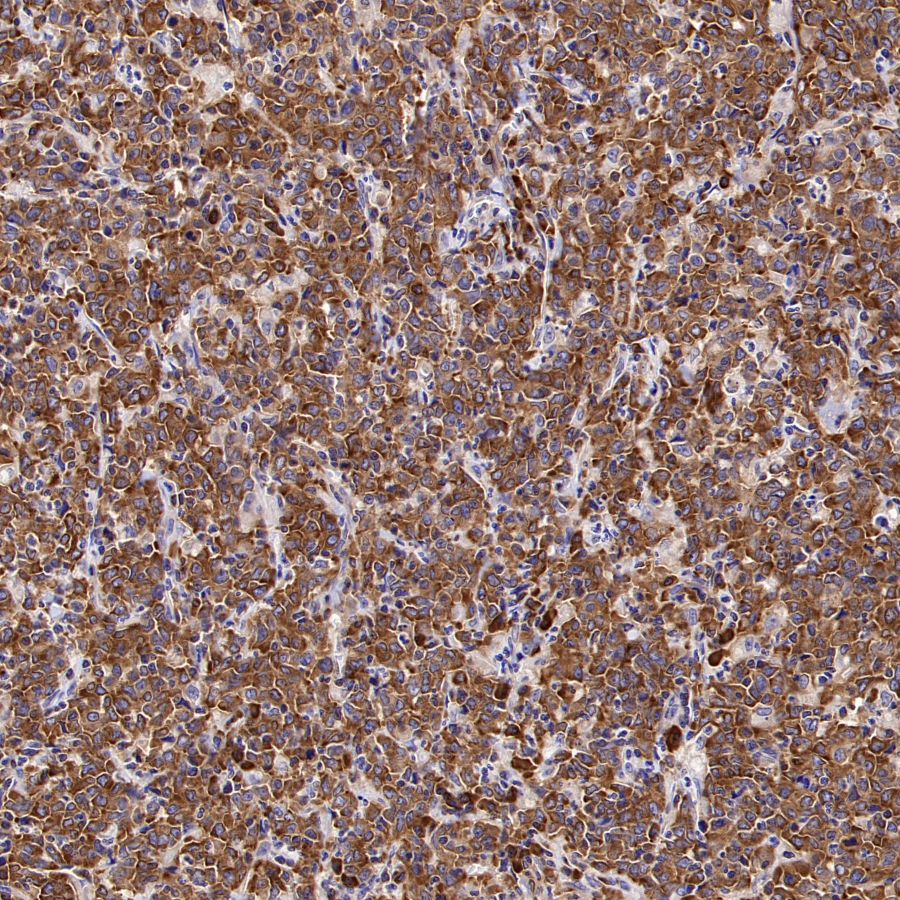 eEF2 Recombinant Rabbit mAb (S-1976-35)