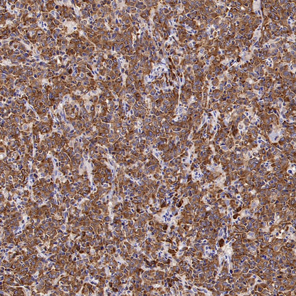 eEF2 Recombinant Rabbit mAb (S-1976-35)