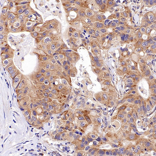 TMEM106B Recombinant Rabbit mAb (S-2362-33)