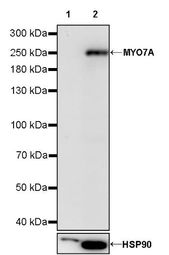 MYO7A Recombinant Rabbit mAb (S-2284-21)
