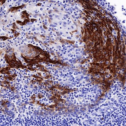 LYPD3/C4.4A Recombinant Rabbit mAb (S-R222)