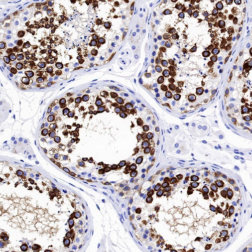 DDX4 Recombinant Rabbit mAb (S-1570-48)