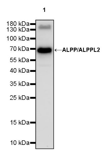 ALPP/ALPPL2 Recombinant Rabbit mAb (S-2089-36)