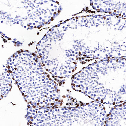 Androgen Receptor Recombinant Rabbit mAb (SDT-R157)
