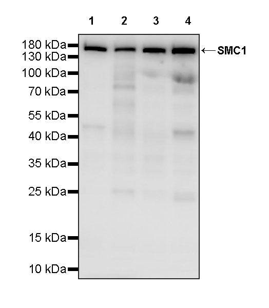 SMC1 Recombinant Rabbit mAb (S-4147-54)