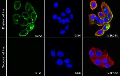 NaPi2b/SLC34A2 Recombinant Rabbit mAb (SDT-R229)
