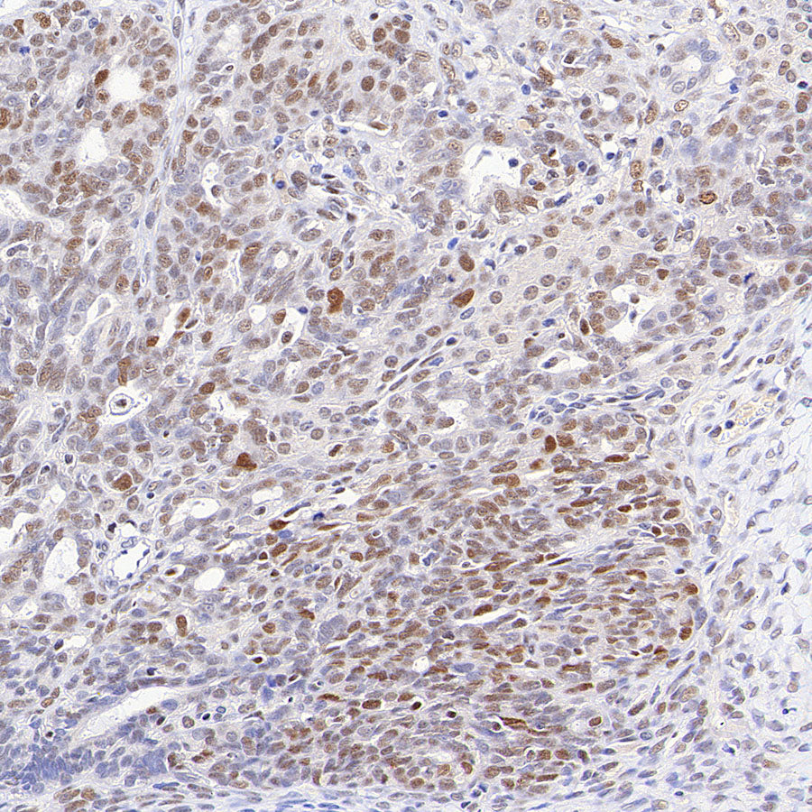 Chk2 Recombinant Rabbit mAb