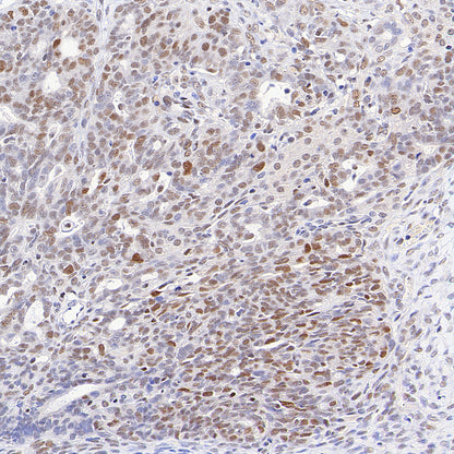 Chk2 Recombinant Rabbit mAb