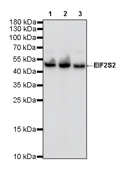 EIF2S2 Rabbit Polyclonal Antibody