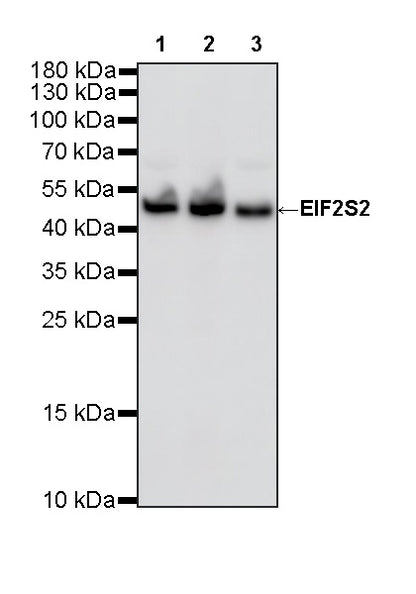 EIF2S2 Rabbit Polyclonal Antibody