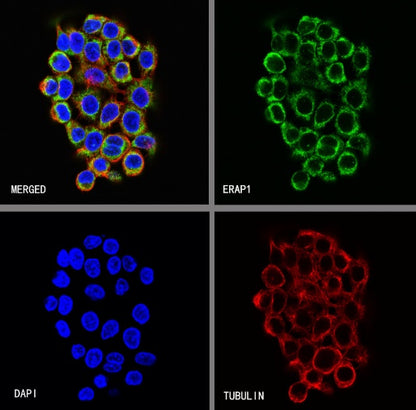 ERAP1 Recombinant Rabbit mAb (S-2509-38)