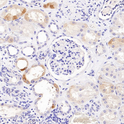 GDF3 Recombinant Rabbit mAb (S-3049-3)