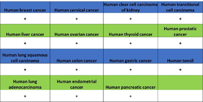 PML Recombinant Rabbit mAb (S-1908-60)