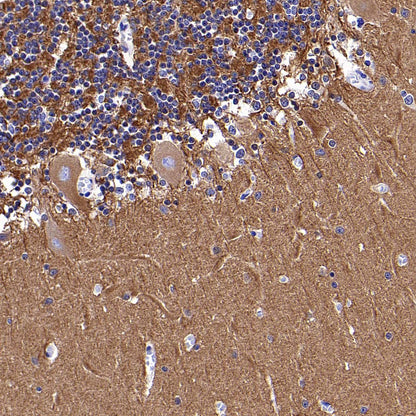 Beta III Tubulin Recombinant Rabbit mAb (S-5529)