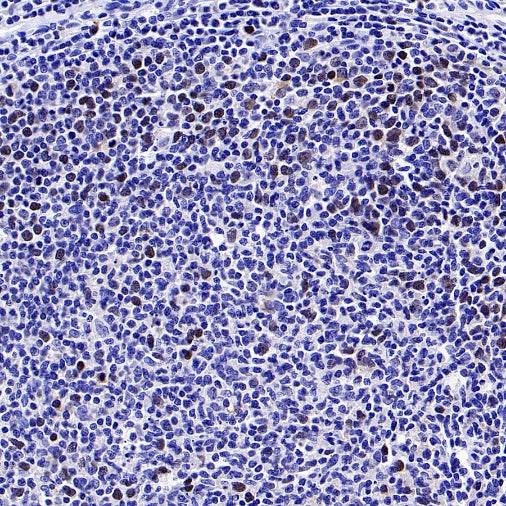 Phospho-Rb (Ser807/811) Recombinant Rabbit mAb (S-2215-52)