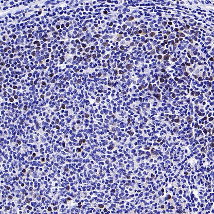 Phospho-Rb (Ser807/811) Recombinant Rabbit mAb (S-2215-52)